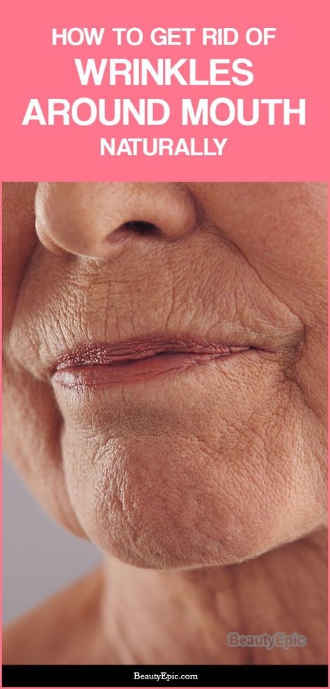 It is easy and inexpensive to reduce and get rid of wrinkles around your mouth. Of course, you have to make a little effort and exercise patience. Here are a few remedies