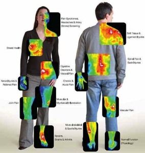 About Thermal Imaging Referred Pain, Health Images, Heat Map, Health Screening, Body Scanning, Breast Health, Health Nut, Experimental Photography, Thermal Imaging