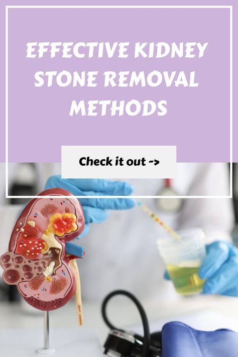 Medical professional demonstrating kidney stone removal using a model. Kidney Stone Relief, Educating Yourself, Kidney Stone, Health Podcast, Unhealthy Diet, Holistic Remedies, Urinary Tract, Doterra Essential Oils, Kids Health