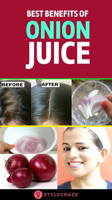 Red Onion Benefits, Garlic For Hair Growth, Onion Benefits, Juice For Hair, Onion Juice For Hair, Garlic Juice, Hair Grow Faster, Onion For Hair, Onion Juice