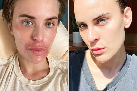 Tallulah Willis Gets Candid About Her Skin Struggles—and Says She's 'Truly Proud' of Her Progress Tallulah Willis, Fantasy Fiction Books, Spooky Places, Demi Moore, Attitude Of Gratitude, Bruce Willis, Progress Pictures, Cute Family, Rock Stars