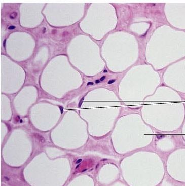 Adipose tissue acts as an insulating layer, helping to reduce heat loss through the skin. It also has a protective function, providing mechanical protection and support around some of the major organs, e.g. kidneys. Adipose tissue is also a means of energy storage. Ancient Egypt Pyramids, Histology Slides, Egypt Pyramids, Microscopic Photography, Cells And Tissues, Connective Tissue, Adipose Tissue, Skin Tissue, Body Anatomy