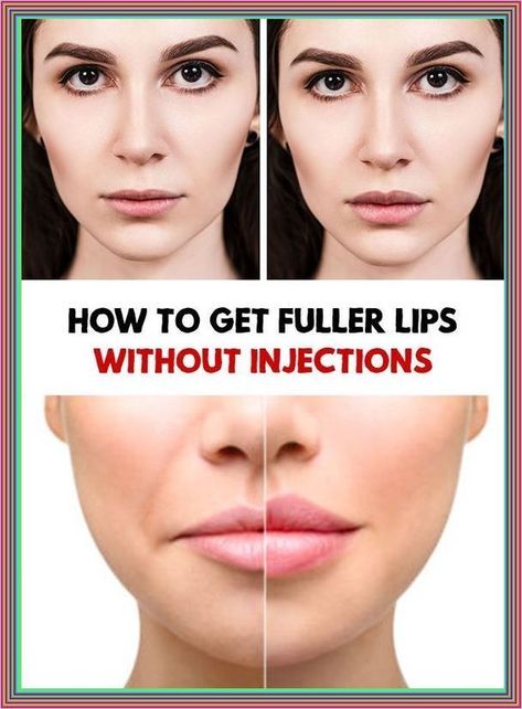 HOW TO GET FULLER AND BETTER LIPS WITHOUT SURGERY??? Get Bigger Lips, Bigger Lips Makeup, Bigger Lips, Fuller Lips Naturally, Healthy Book, Fuller Lips, Healthy Advice, Lip Fillers, Health Promotion