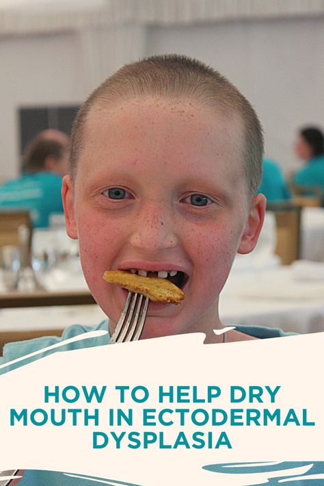 Hoarse voice? Difficulty swallowing? Dry mouth may be cause your issue. Learn about how ectodermal dysplasia can affect your salivary glands and what you can do to manage it. Difficulty Swallowing Food, Apples For Applesauce, Swallowing Problems, Salivary Glands, Salivary Gland, Mammary Gland, Health Tonic, Dry Mouth, Sweat Gland