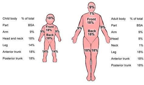 Rule of 9 for burn victims | PTA | Pinterest | Nine D'urso and Html Rules Of 9 Burns, Rule Of 9 Burns Nursing, Rule Of Nines For Burns, Rule Of 9 Burns, Burns Nursing, Rule Of Nines, Emt Basic, Burn Victims, Emt Study