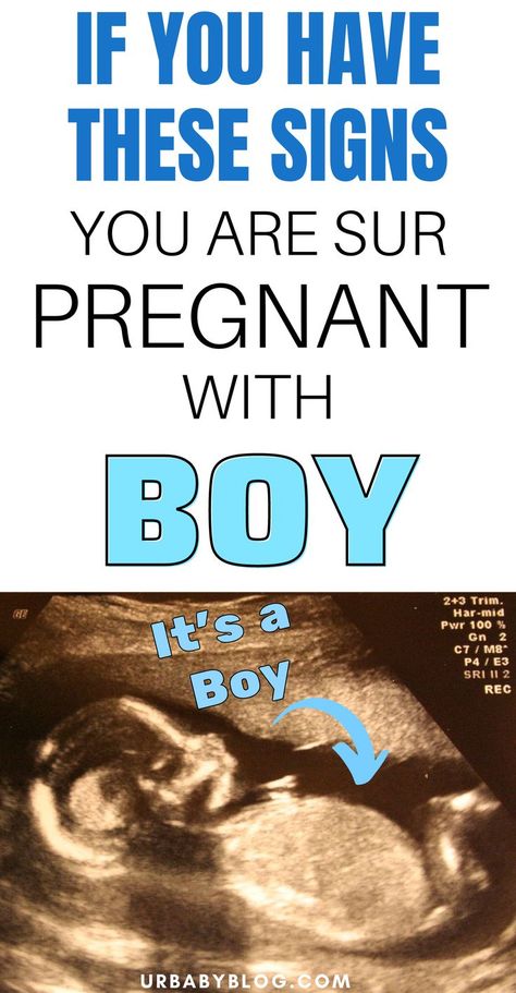 Are you wondering if you're having a girl or a boy? Your body does react different when you're pregnant with a girl vs a boy. Learn what the signs of a boy are. Signs Your Pregnant, Boy Vs Girl Pregnancy, Boy Or Girl Prediction, Signs You Are Pregnant, Chinese Gender Chart, Phonics Reading Activities, Boy Or Girl Sign, Gender Chart, Baby Gender Prediction