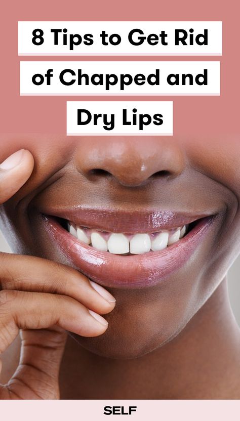 Severely Chapped Lips Remedy, Peeling Lips Remedies, Remedy For Dry Lips, Dry Chapped Lips Remedy, Chap Lips Remedy, How To Help Dry Lips, Hydrated Lips Tips, Smooth Lips No Lines, Severe Chapped Lips