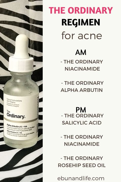 Ordinary Skincare Routine Acne, The Ordinary Skincare Routine Acne, The Ordinary Skincare Review, Skincare Routine Acne, Ordinary Skincare Routine, The Ordinary Skincare Routine, Ordinary Skincare, Haut Routine, Skin Care Routine For 20s