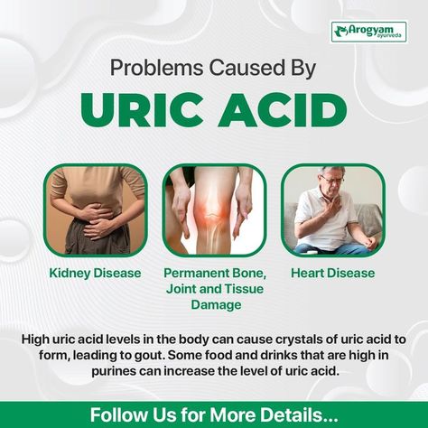 #cause #high #uricacid #level #waste #product #found #blood #bone #tissue #damage #food #drinks #highpurines #problems #ayurveda #natural #treatment #Arogyamjalandhar
#arogyamclinic #foryou #viral #trending #pinterest #explore Uric Acid Levels, Uric Acid, Healthy Advice, Kidney Health, How To Do Yoga, Ayurveda, Natural Health, Natural Skin Care, Chemicals