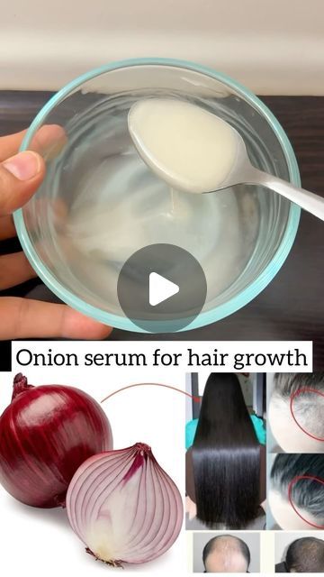 Hair Growth Ingredients, Quick Hair Growth, Extreme Hair Growth, Health Care Professionals, Onion Juice, Improve Hair Growth, Shortcut Keys, Beauty Diet, Extreme Hair