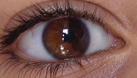 Sectoral heterochromia brown eyes Sectoral Heterochromia Brown, Brown Heterochromia Eyes, Heterochromia Eyes Aesthetic, Eye Claim, Sectoral Heterochromia, Central Heterochromia, Dr Claims, Heterochromia Eyes, Eyes Ideas