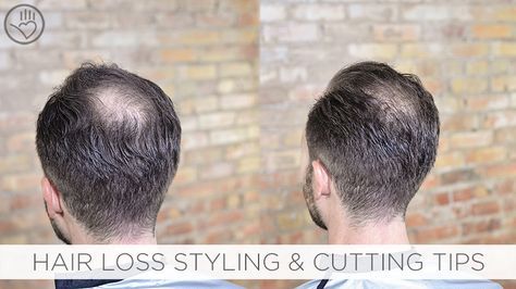 Discover how to create the illusion of thicker looking hair for thinning or balding clients along with creating balance between dense and light hair. Regrow Thinning Hair, Haircuts For Balding Men, Balding Mens Hairstyles, Male Pattern Baldness, Pattern Baldness, Bald Hair, Bald Men, Lost Hair, Thinning Hair