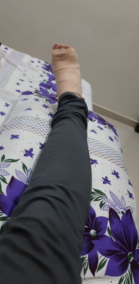 Leg Injury Insta Story, Back Injury Snapchat, Football Injury Snapchat, Fractured Leg Snap, Hand Plaster Fracture Snap, Leg Photo Snapchat, Leg Accident Real Pic In Hospital, Hospital Leg Injury, Hand Fracture Fake Story