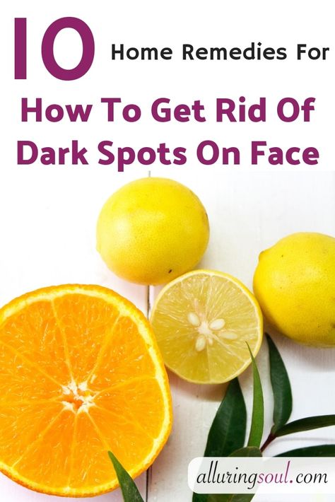 Dark spots on face form due to acne, blackheads, sun tan etc. Check out home remedies for how to remove black and dark spots on face which gives fast result Frankincense Anti Aging, Black Spots On Face, Face Form, Brown Spots On Skin, Aloe Vera Face Mask, Dark Spots On Face, Brown Spots Removal, Brown Spots On Face, Skin Spots