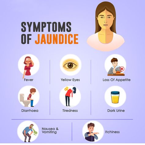 If you facing the problems such as fever , yellow eyes ,diarrhoea , tiredness , itchiness etc this all are various symptoms of Jaundice. For the solution of this you need to consult your doctor or to take care of this with the help of Hashmi's Jaundinil Capsule. #ayurveda #hashmi Jaundice Symptoms, Bilirubin Levels, Liver Function Test, Blood Disorders, Pathology Lab, Med School Motivation, Liver Function, Yellow Fever, Medical Tests