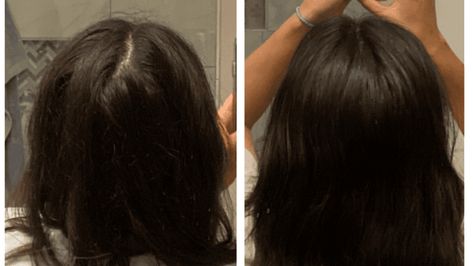 How To Easily Get Rid Of Back Hair Part [Tips + Prevention] - Hello Mia Wilson How To Get Rid Of A Cowlick, Cowlicks Back Of Head, How To Style Hair With Cowlicks, Back Part In Hair, How To Fix A Cowlick Back Of Head, Cowlick Back Of Head, Hair Cowlick, Cowlick Hair, Cowlick Hairstyles