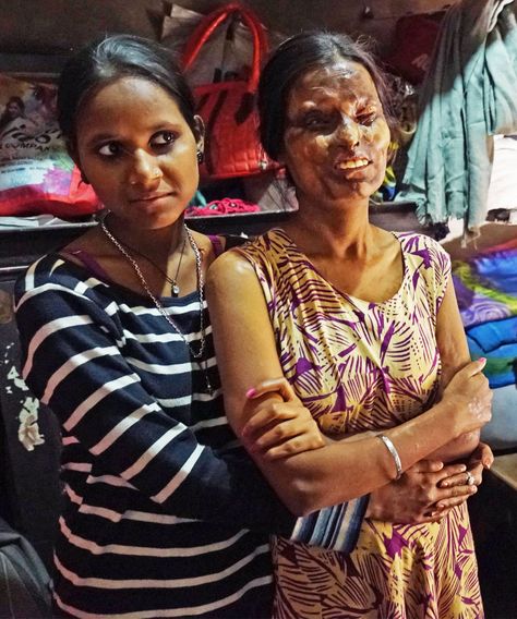 How one woman found solace after being attacked by her father Cafe India, Acid Attack, Homemade Garden Decorations, Women Survivor, Some Nights, Heavy Heart, Yahoo News, Come Home, Faith In Humanity