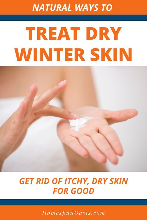 Natural Ways to Treat Dry Winter Skin | Sick of dry skin in the winter? Get rid of your itchy, dry winter skin for good with these natural remedies. Dry Skin Remedies For Body Winter, Dry Skin Home Remedies, Super Dry Skin, Ski Slope, Extremely Dry Skin, Dry Flaky Skin, Dry Skin On Face, Dry Winter Skin, Dry Skin Remedies