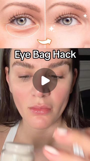 Sarah Fraggis on Instagram: "Next time you wake up with eye bags - get out your guasha and follow this routine.

✅Don't forget to save this video 

1st apply a nourishing topical that will allow the tool to glide. 

I'm using the Joker peptides! These are my favorite, as they aide in rebuilding and tighting the skin. (LESS crows feet wrinkle) 

Next, take your guasha (you can use one! I'm using two in the video because I have two) & go up and out. 

This is going to help get rid of the fluid & flush it down, giving you a healthy undereye. 

All tools and products used can be found at filterlessera.com along with full tutorials.  Link in bio

📸 Take your before and after pictures so ,you can track YOUR results

So happy you're here!

Xoxo- Sarah

#eyebags #darkcircles #puffyeyes #guashatut Crows Feet Wrinkles, Facial Cupping, Face Yoga, After Pictures, Puffy Eyes, Before And After Pictures, Eye Bags, Gua Sha, The Joker