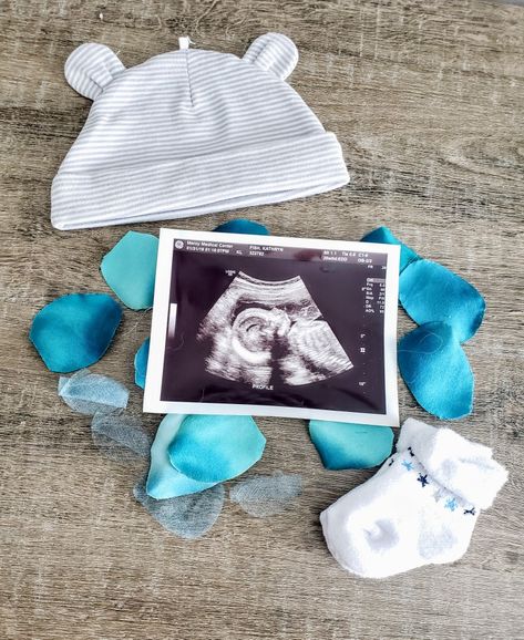 Its A Boy Anuncio, It’s A Boy, Boy Announcement Ideas, Baby Boy Gender Announcement, Gender Announcement Pictures, Baby Boy Announcement Ideas, Boy Gender Announcement, Gender Announcement Ideas, Baby Gender Reveal Announcement