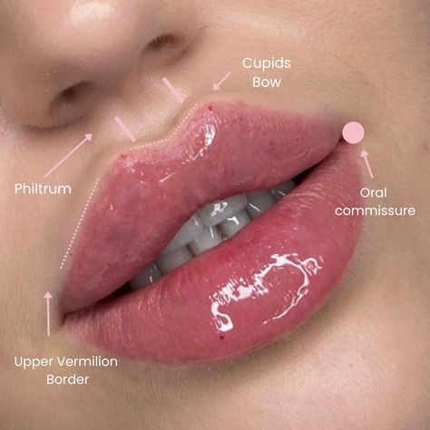 Gorgeous Lip Anatomy When positioned in the subdermal fat or muscular tissue, hyaluronic acid will act as a filler, shaping or plumping' the tissue. . . . #russianlip #russianlipslondon Lip Filler Shape Ideas Black Women, Lip Fillers 2ml, Lip Filler Quotes Sayings, Lip Filler Cupids Bow, Diy Lip Filler, Lip Fillers Inspiration, Heart Shaped Lip Filler, Lips Fillers Shapes, Different Lip Filler Shapes