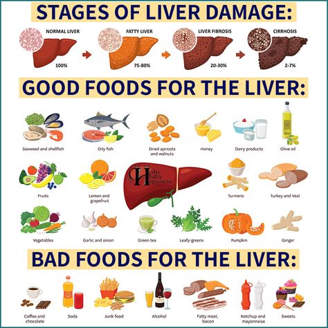 Foods For Liver Health, Liver Healthy Foods, Liver Cleanse Juice, Healthy Liver Diet, Liver Damage, Kidney Detox, Chocolate Bacon, Liver Diet, Baking Soda Shampoo