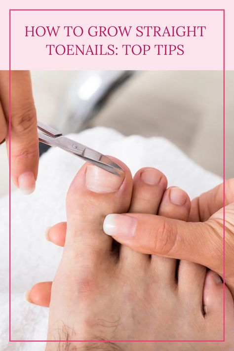 Discover the best ways to promote straight toenail growth and prevent ingrown toenails. Click to learn more! How To Get Healthy Toenails, Toenail Growth Fast, Diy Ingrown Toenail Remedy, How To Whiten Toenails, Toe Nail Growth Remedies, Ingrown Toenail Remedy, Curled Toenails, Ingrown Toenail Remedies, Curved Toenails