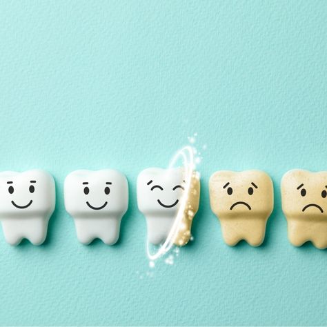 When the white, hard outer layer of enamel on your teeth is eroded away, it exposes the dentin beneath. Dentin is the yellow-ish tissue that makes up the core of each tooth. Yellow Teeth, Tooth Enamel, Skin Colour, Wellness Routine, White Teeth, Healthy Teeth, Oral Hygiene, Beautiful Smile, Your Beautiful