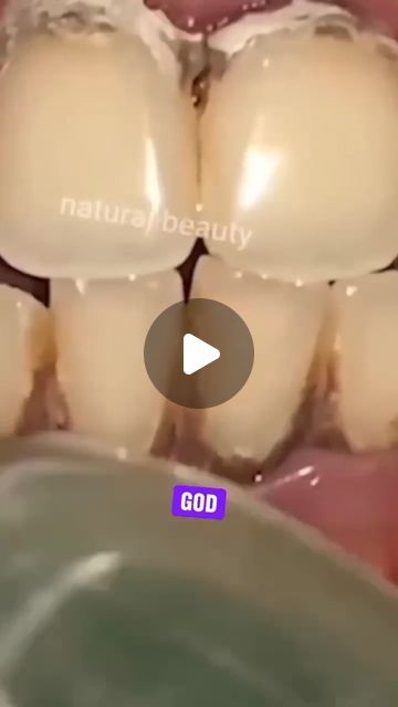 Lose Weight on Instagram: "Remove Tartar and Yellowness From Your Teeth 
Follow @womanbodytip 
#teethwhitening #yellowteeth #remedy #naturalremedies" Remove Tartar From Teeth At Home, Tumeric Teeth Whitening, Natural Teeth Whitening Diy, Tartar Teeth, Teeth Covers, Tartar Removal, Teeth Whitening Diy, Fence Designs, Privacy Fence Designs