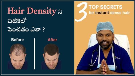 Top 3 Secrets to Instantly Increase Hair Density | #DrJohnWatts | by Dr. John Watts | Apr, 2022 | Medium Types Of Camouflage, Increase Hair Density, Nice Hairstyle, Shampoo Brands, Best Hair Transplant, Hair Specialist, Volumizing Shampoo, Fuller Hair, Hair Density