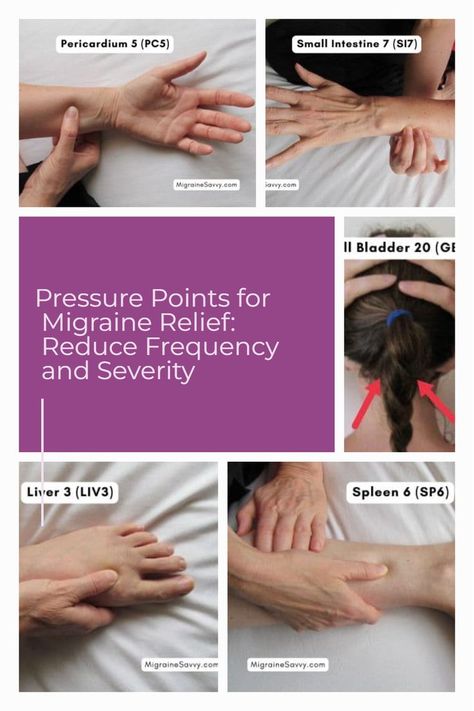 Here are the best acupressure points for migraine relief. These are traditional chinese medicine points used for centuries to treat migraine headache for effective relief. Learn the routine at MigraineSavvy.com @migrainesavvy Headache Pressure Points Migraine, Pressure Points For Headaches Migraine, Acupressure For Migraine, Menstrual Headache Relief, Pressure Headache Relief, Migraine Relief Pressure Points, Headache Relief Pressure Points, Migraine Pressure Points, Pressure Points For Headaches