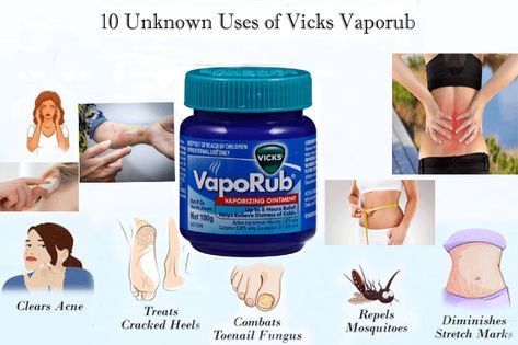 10 Unknown Uses of Vicks Vaporub - wiselancer Vicks Vaporub Benefits, Vaporub Uses, Vicks Vapor Rub, Medicine Kit, Vicks Vaporub Uses, Uses For Vicks, Cedar Oil, Vapor Rub, Women Health Care