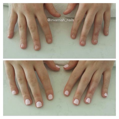 Before and after. Nails were short, bitten and brittle. After gel enhancements they look and feel amazing!! That will stop those naughty habits :) Nail Ideas For Short Bitten Nails, Nail Biters Before And After, Bitten Nails Transformation, Short Bitten Nails Painted, Bitten Nails Before And After, Before And After Nails, Nails Biting, Short Bitten Nails, Small Nail Beds