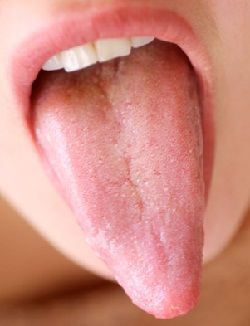 Póngase esto bajo la lengua, por favor. Tongue Health, Utila, Back To Nature, Health Info, Homeopathy, Natural Medicine, Health Diet, Alternative Medicine, Health Remedies