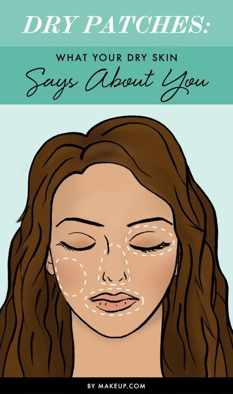 Dry Patches — This Is What Your Dry Skin Might Be Saying About You Nose Peeling, Brown Spots On Skin, Dry Skin Remedies, Combination Skin Type, Skin Patches, Nose Shapes, Dry Skin Patches, Spots On Face, Peeling Skin