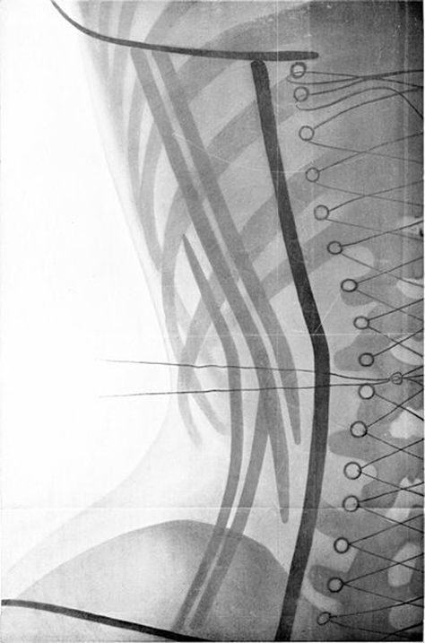 The Corset X-Rays of Dr Ludovic O'Followell (1908) – The Public Domain Review Xray Art, X-ray Images, X Rays, Vintage Corset, Art Printables, Body Curves, Victorian Women, Mixed Media Artwork, Media Images