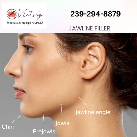 Improve Jawline, Jawline Filler, Facial Profile, Facial Proportions, Med Spa, Face Care, Naples, Healthy Skin, Victorious