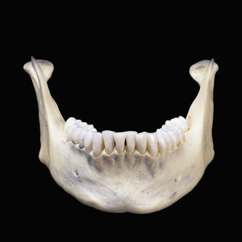 Bottom Jaw Skull, Anatomy Bones, Head Anatomy, Skull Reference, Skeleton Bones, Anatomy For Artists, Jaw Bone, Skull Drawing, Human Skull