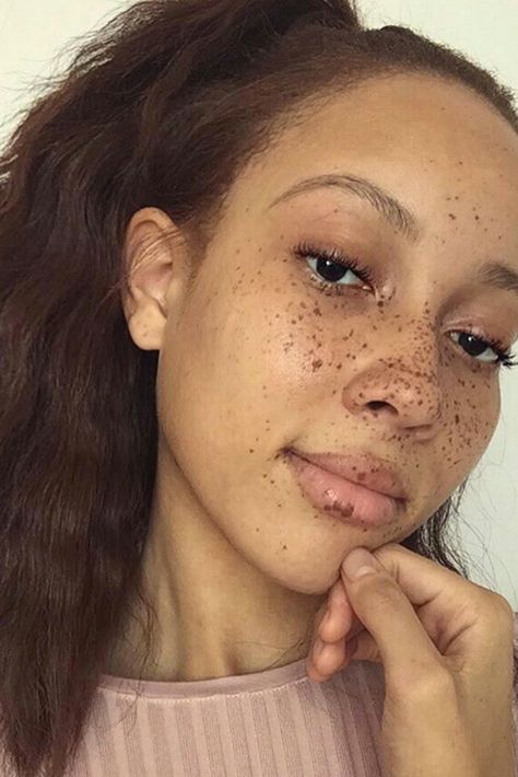 Fab and Freckled | These teeny speckled wonders look absolutely beautiful against brown skin. Freckles On Face, Woman With Freckles, Black Freckles, Tattooed Freckles, People With Freckles, Women With Freckles, Fake Freckles, Freckles Makeup, Beautiful Freckles