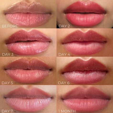 Each lip healing journey is unique, with varying degrees of intensity. Here's a glimpse into a few different healing processes.

Save this post for reference to show your next client 💕 Lip Healing, Permanent Lipstick, Lip Tattoos, Cosmetic Treatments, Makeup Tattoos, Makeup Obsession, Permanent Makeup, Healing Process, Healing Journey