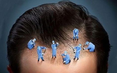 Hair Surgery, Skin And Hair Clinic, Hair Transplant Surgery, Best Hair Transplant, Creative Advertising Design, Hair Clinic, Graphic Design Ads, Beauty Clinic, Skin Care Clinic