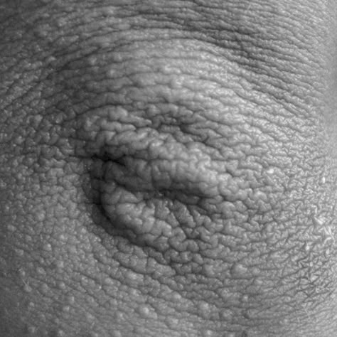 Abstract black-and-white photographs depict beauty in the human body - Contented Imperfection Photography, Human Body Photography, Human Skin Texture, Human Ribs, Close Photography, Body Art Photography, Photography Themes, Shotting Photo, Body Photography