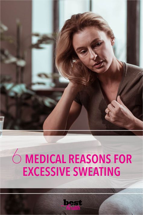 One of these issues could explain why you sweat so much. Why Do I Sweat So Much, How To Stop Sweating So Much, Excessive Sweating Causes, Feeling Embarrassed, Over Sweating, Sweating Too Much, Face Sweating, Stop Sweating, Heavy Sweating