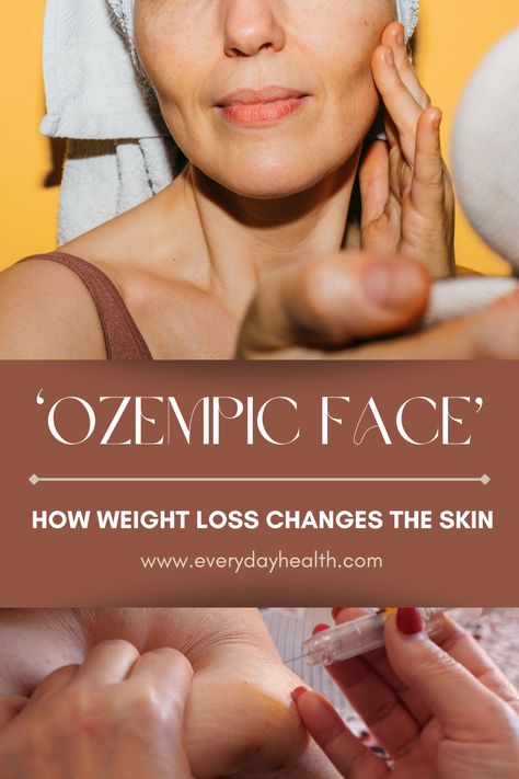 Ozempic Face, Healthy Beauty, Lose 50 Pounds, Skin Texture, Health Advice, Skin Tightening, Weight Management, The Skin, Healthy Tips