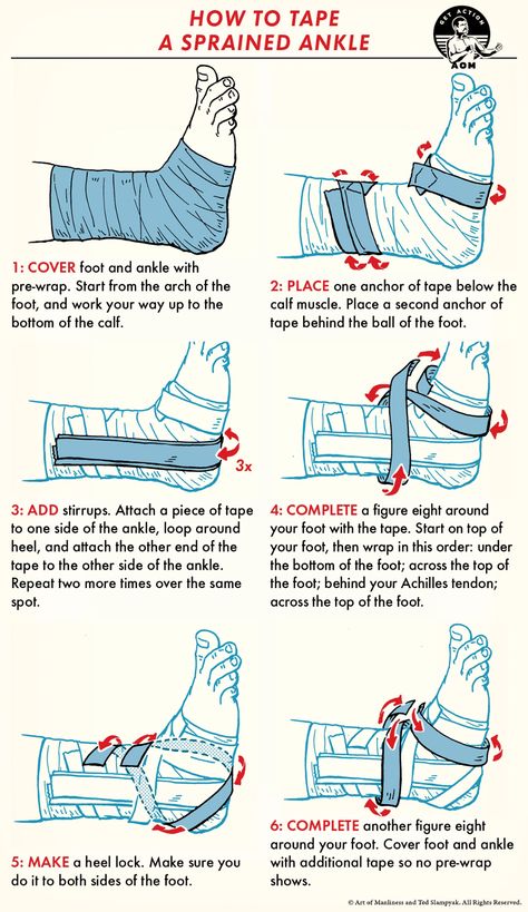 How to Tape an Ankle | The Art of Manliness First Aid Tips, Dark Things, Sports Therapy, Survival Skills Life Hacks, Survival Life Hacks, Sprained Ankle, Survival Techniques, Survival Life, Medical Knowledge