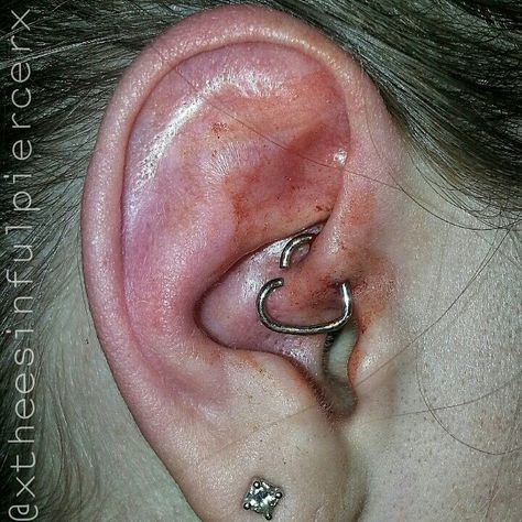 Daith Piercing. Done with 16G Surgical Steel Heart shaped ring. Procedure done by #CandyTheePiercer at #SinfulArtStudio in #VacavilleCA. Daith Piercing With Airpods, Daith Piercing Aftercare, Daith Piercing Migraine, Ear Piercing Daith Heart, Heart Daith, Diamond Daith Earring, Daith Ring, Daith Rings, Heart Shaped Ring