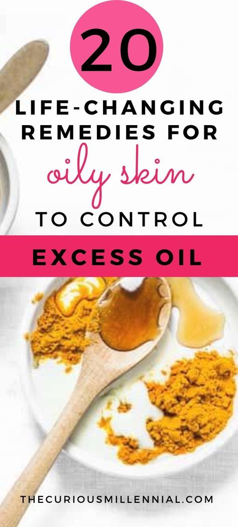 Oily Face Remedy, Remedies For Oily Skin, Face Remedies, Oily Skin Face, Oily Skin Remedy, Treating Acne, Skin Care Home Remedies, Lotion For Oily Skin, Oily Skin Acne