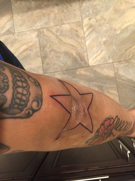 Star Around Elbow Tattoo, Star On Elbow Tattoo, Star Tattoo On Knee, Star On Knee Tattoo, Star Tattoo Knee, Star Tattoo Elbow, Elbows Tattoo, Star Tattoo On Elbow, Knee Star Tattoo