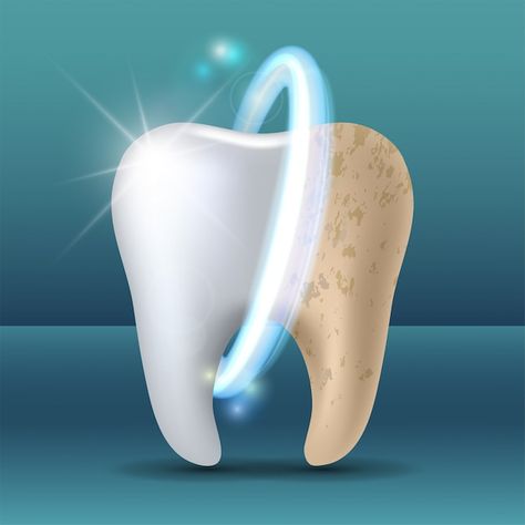 Clean and dirty tooth before and after w... | Premium Vector #Freepik #vector #medical #doctor #health #hospital Dental Images, Teeth Whitening Procedure, Dental Posters, Dentist Clinic, Kedokteran Gigi, Discolored Teeth, Dental Hospital, Loose Tooth, Dental Design