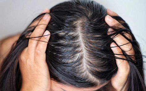 If you are looking for a solution for your oily scalp and dry hair ends, then this article is for you! Many factors like skin conditions, overwashing, usage of heating tools, wrong hair care products leads to combination hair type. Read on to find out the answers. Dry Ends Hair, Dry Hair Ends, Clean Shampoo, Oily Roots, Hair Scrub, Oily Scalp, Greasy Hair Hairstyles, Festival Hair, Oily Hair